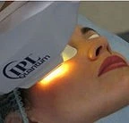 Фотоомоложение