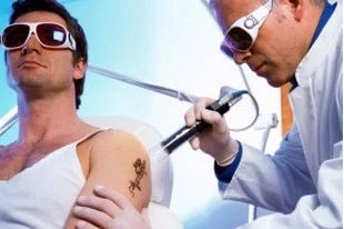 Удаление татуировок, татуажа бровей